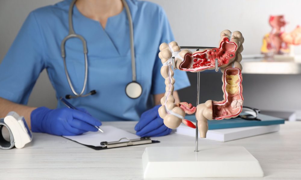 Gastroenterologist,With,Human,Colon,Model,At,Table,In,Clinic,,Closeup